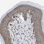 SQLE Polyclonal Antibody