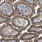 LPPR5 Polyclonal Antibody