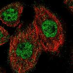 ZNF449 Polyclonal Antibody