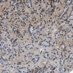 ZNF449 Antibody in Immunohistochemistry (IHC)
