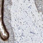C14orf177 Antibody in Immunohistochemistry (Paraffin) (IHC (P))