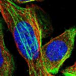 TMEM17 Polyclonal Antibody