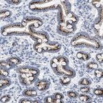 TMEM17 Antibody in Immunohistochemistry (Paraffin) (IHC (P))