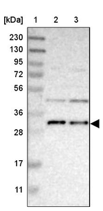 TMEM17 Antibody in Western Blot (WB)