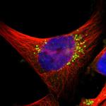 TMEM87A Polyclonal Antibody