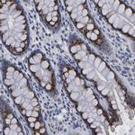 TMEM87A Antibody in Immunohistochemistry (Paraffin) (IHC (P))