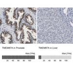 TMEM87A Antibody in Immunohistochemistry (IHC)