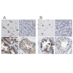 TMEM87A Antibody in Immunohistochemistry (IHC)
