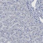 TMEM87A Antibody in Immunohistochemistry (IHC)