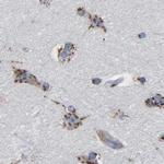 TMEM87A Antibody in Immunohistochemistry (IHC)