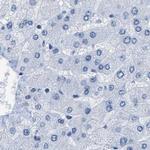 NKCC2 Antibody in Immunohistochemistry (IHC)