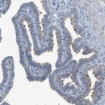 TTBK2 Antibody in Immunohistochemistry (Paraffin) (IHC (P))