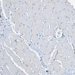 TTBK2 Antibody in Immunohistochemistry (Paraffin) (IHC (P))