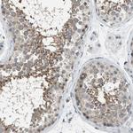 TTBK2 Antibody in Immunohistochemistry (Paraffin) (IHC (P))
