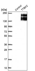 TTBK2 Antibody in Western Blot (WB)