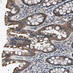 PTK9 Antibody in Immunohistochemistry (Paraffin) (IHC (P))