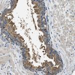 PTK9 Antibody in Immunohistochemistry (Paraffin) (IHC (P))