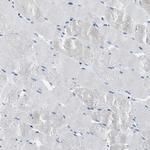 PTK9 Antibody in Immunohistochemistry (Paraffin) (IHC (P))