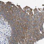 PTK9 Antibody in Immunohistochemistry (Paraffin) (IHC (P))