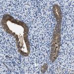 TES Antibody in Immunohistochemistry (Paraffin) (IHC (P))