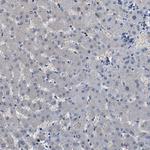 TES Antibody in Immunohistochemistry (Paraffin) (IHC (P))