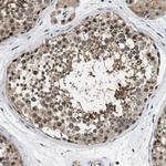 TES Antibody in Immunohistochemistry (Paraffin) (IHC (P))