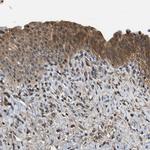 TES Antibody in Immunohistochemistry (Paraffin) (IHC (P))
