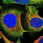 SMPD2 Polyclonal Antibody