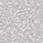 NAV1 Antibody in Immunohistochemistry (Paraffin) (IHC (P))