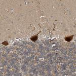 ZFAND5 Antibody in Immunohistochemistry (Paraffin) (IHC (P))