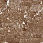 ZFAND5 Antibody in Immunohistochemistry (Paraffin) (IHC (P))