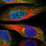 ZNHIT6 Polyclonal Antibody