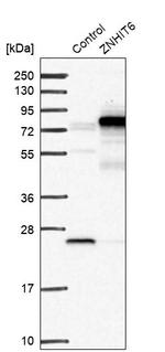 ZNHIT6 Antibody in Western Blot (WB)