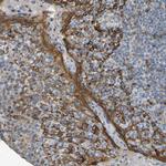 KIAA1671 Antibody in Immunohistochemistry (Paraffin) (IHC (P))
