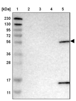 PIGS Antibody in Western Blot (WB)