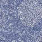 SFXN2 Antibody in Immunohistochemistry (IHC)