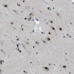 CDR2 Polyclonal Antibody