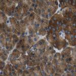 ARFGAP2 Antibody in Immunohistochemistry (IHC)