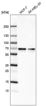 ARFGAP2 Antibody in Western Blot (WB)