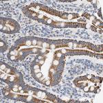 GRPEL2 Antibody in Immunohistochemistry (Paraffin) (IHC (P))