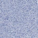 HHATL Antibody in Immunohistochemistry (IHC)