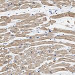 HHATL Antibody in Immunohistochemistry (IHC)