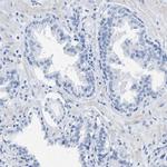 HHATL Antibody in Immunohistochemistry (IHC)