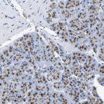 TMEM87A Antibody in Immunohistochemistry (Paraffin) (IHC (P))