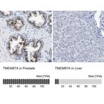 TMEM87A Antibody in Immunohistochemistry (IHC)