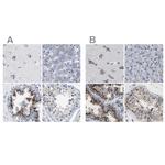 TMEM87A Antibody in Immunohistochemistry (IHC)