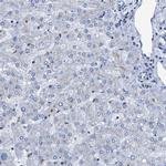TMEM87A Antibody in Immunohistochemistry (IHC)