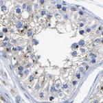 TMEM87A Antibody in Immunohistochemistry (IHC)