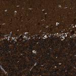 ZSWIM5 Polyclonal Antibody