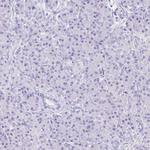GUCA2A Polyclonal Antibody